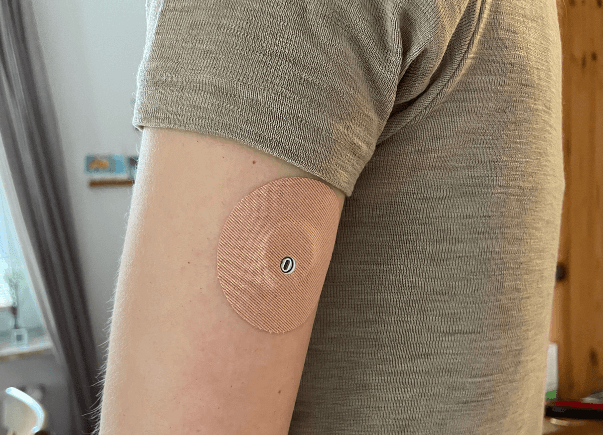sinCephalea Blutzucker-Sensor mit Pflaster am Arm
